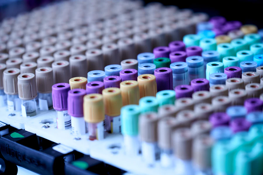 Rows of blood sample collection tubes with coloured caps in a laboratory rack
